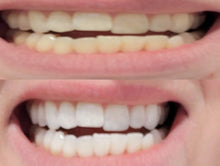 Load image into Gallery viewer, Nano-hydroxyapatite Remineralizing Vegan Fluoride Free Mineral Tooth Powder 1.5oz Organic Ingredients